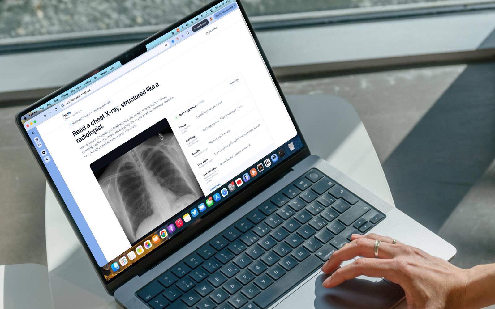 RadAI: turning a research X-ray model into a deployable product
